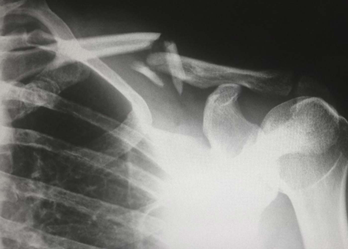 4 Ways Technology is Changing the Business of Personal Injury