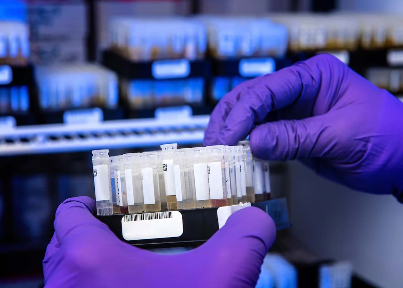 5 Things You Need To Know About Custom Antibody