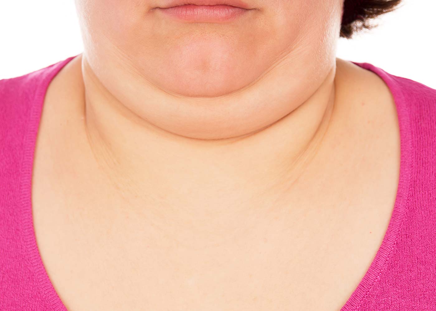 Achieve a Jawline You Can Be Proud Of: 5 Ways to Reduce a Double Chin 
