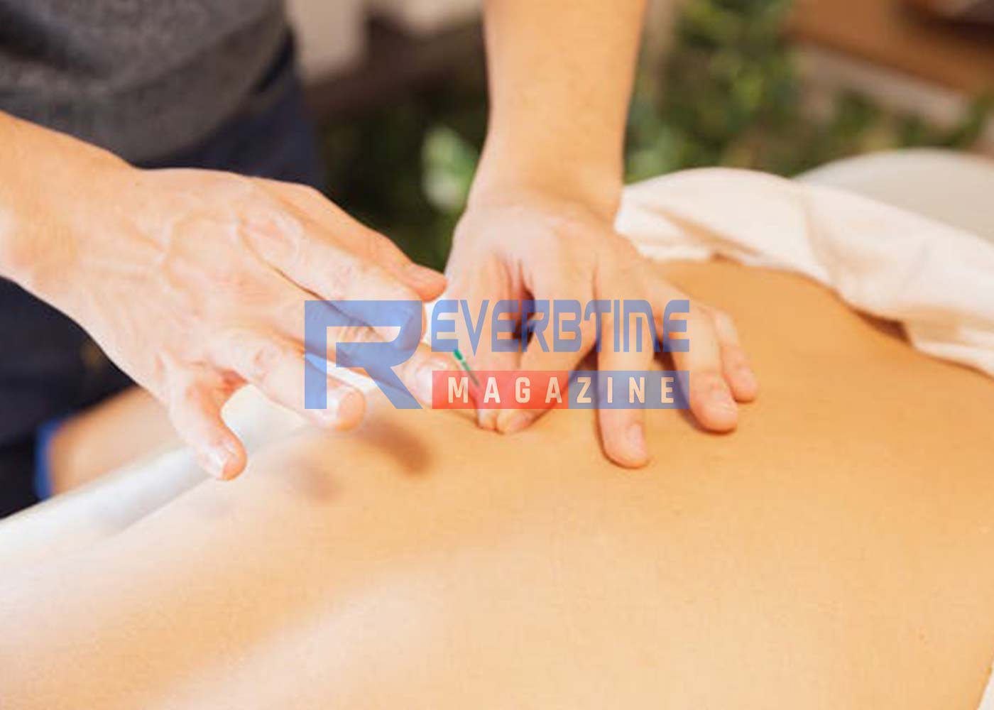6 Health Benefits of Acupuncture