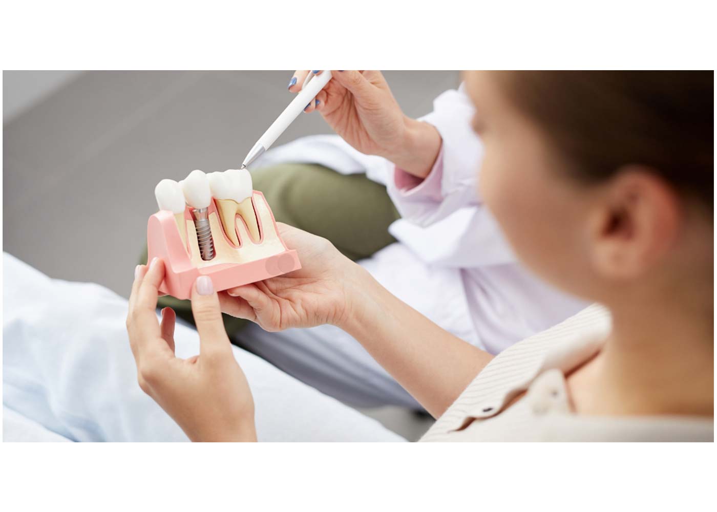 Top Implant Solutions for Dentists: A Closer Look
