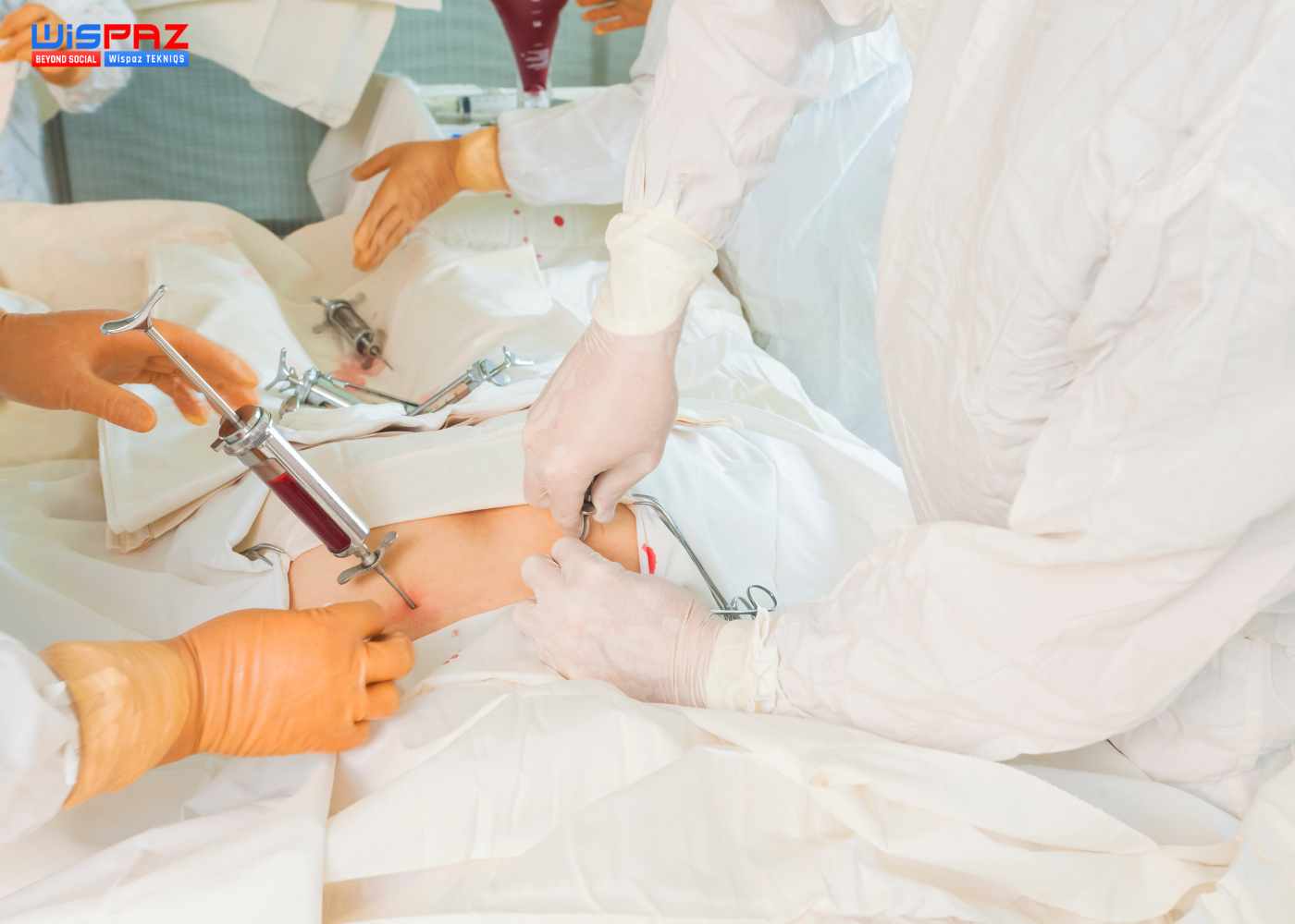 All about Bone Marrow Transplants