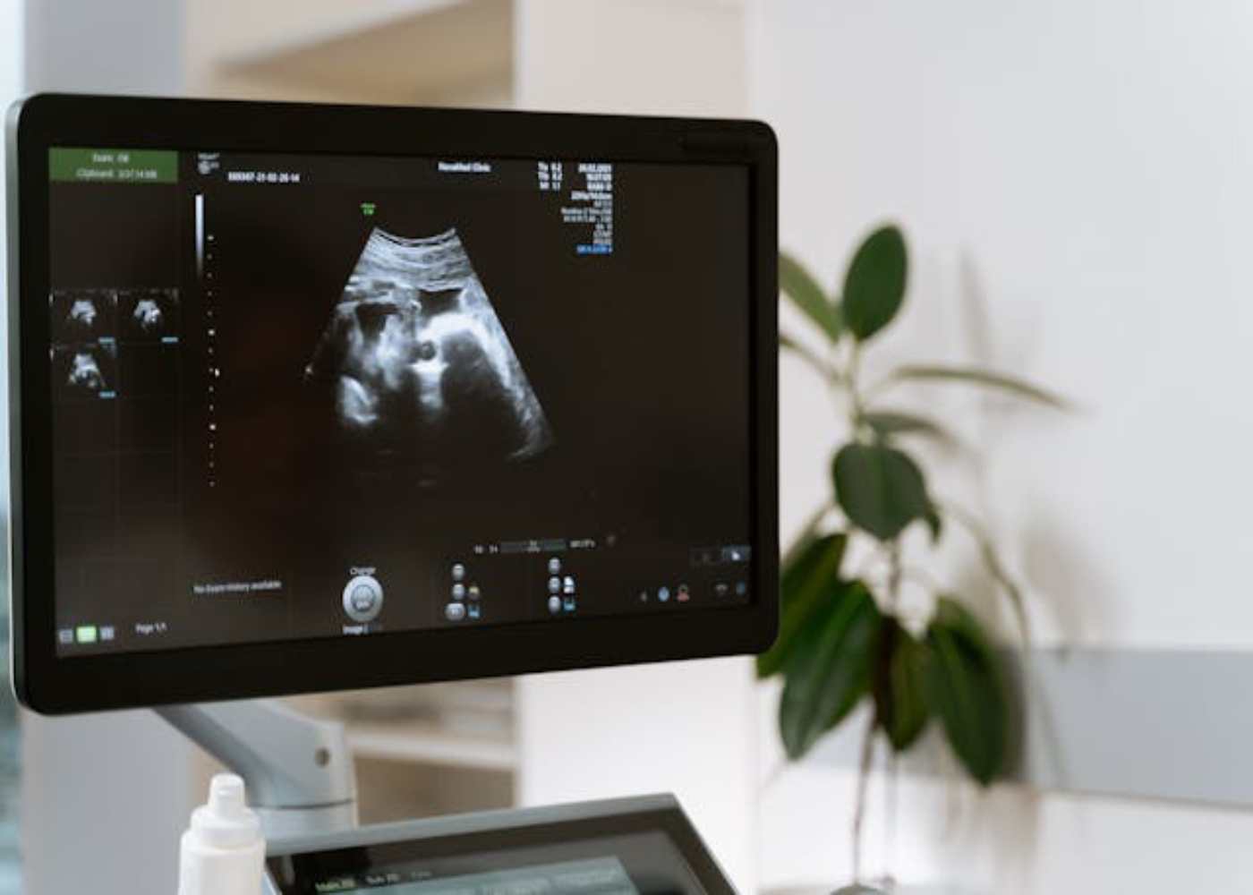  Key Health Advantages You Gain from Ultrasound