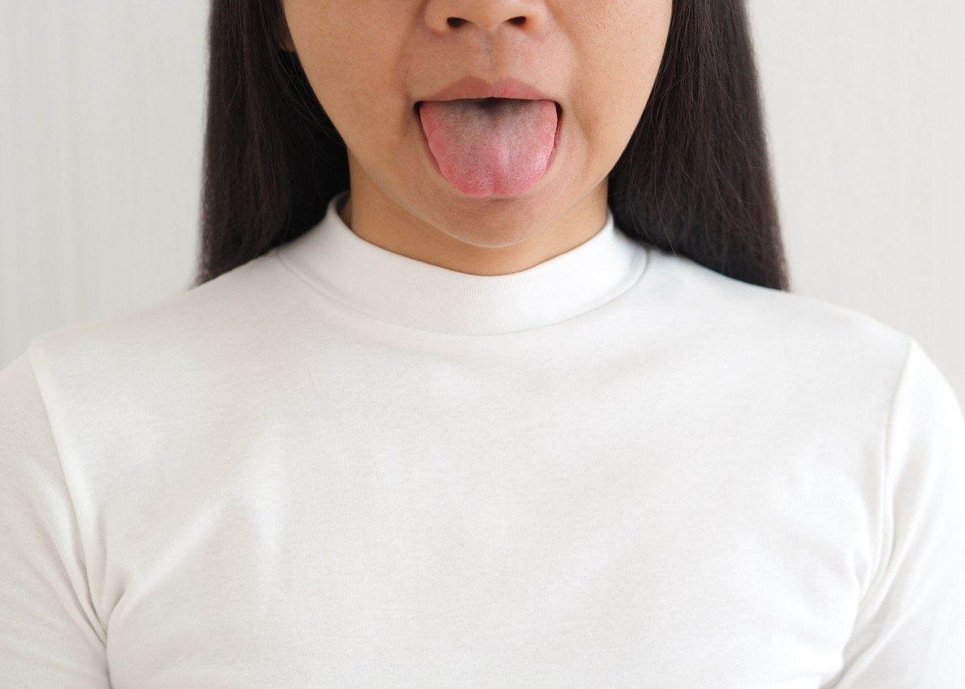 Common Causes for Dry Mouth and How to Find Relief