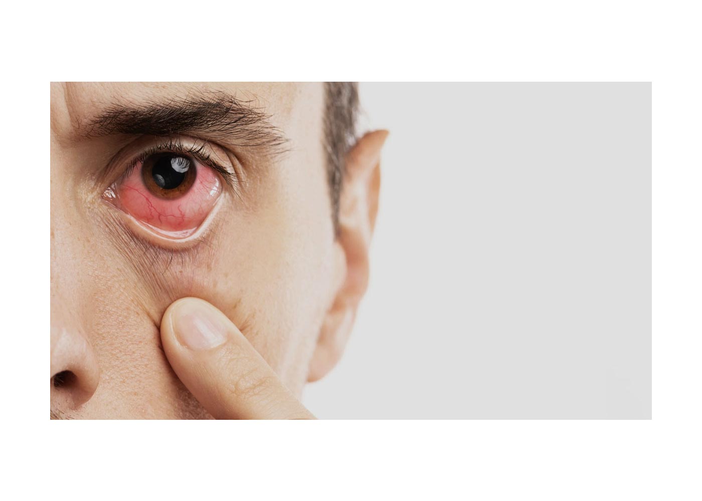 Corneal Diseases: Everything You Need to Know