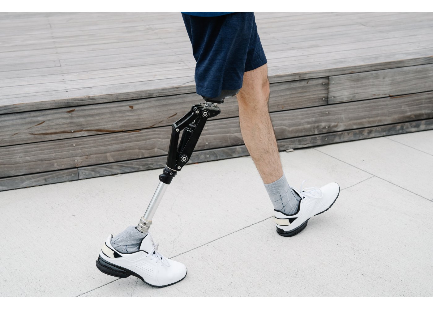 Empowering Lives: Choosing the Right Doctor for Prosthetics