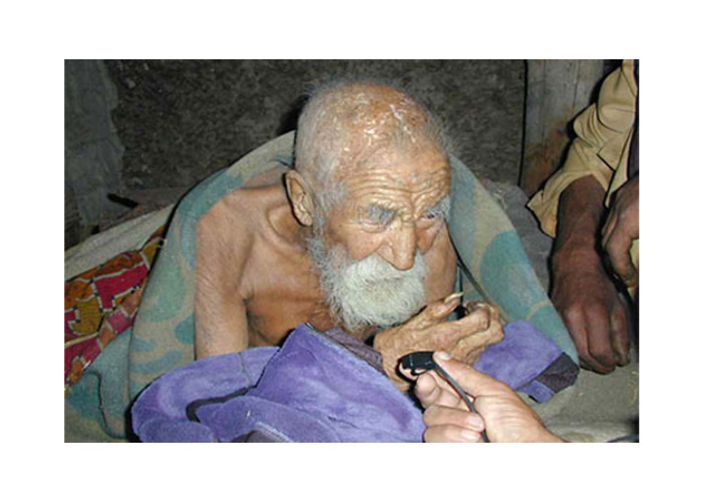 Fact Check: No, There is No 300-Year-Old Man in India