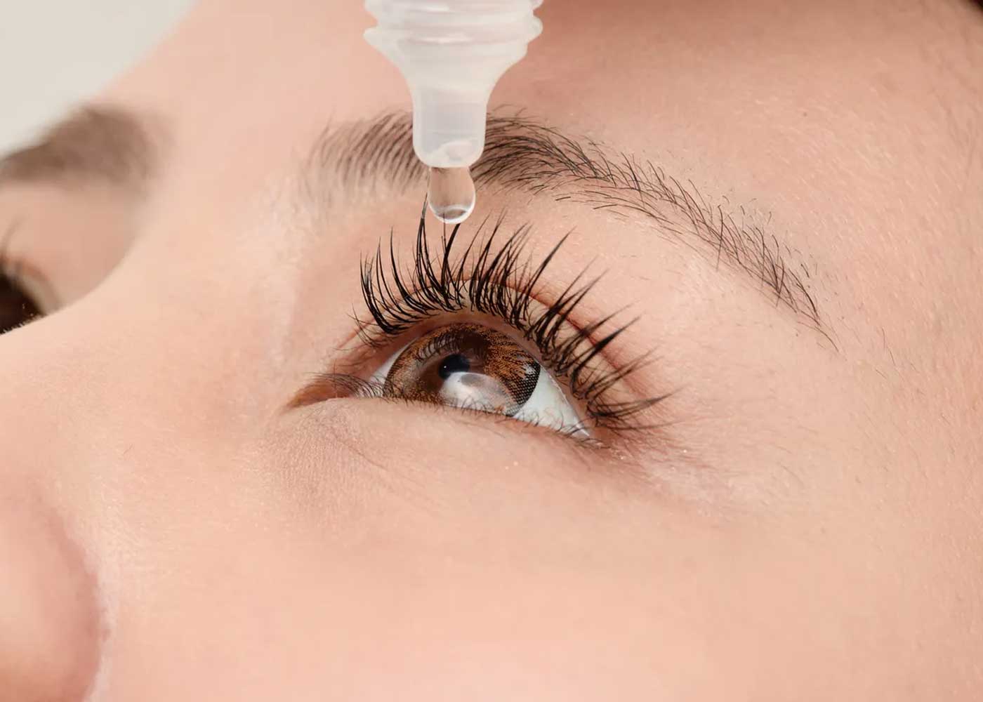 Indian Home Remedies for Itchy Eyes