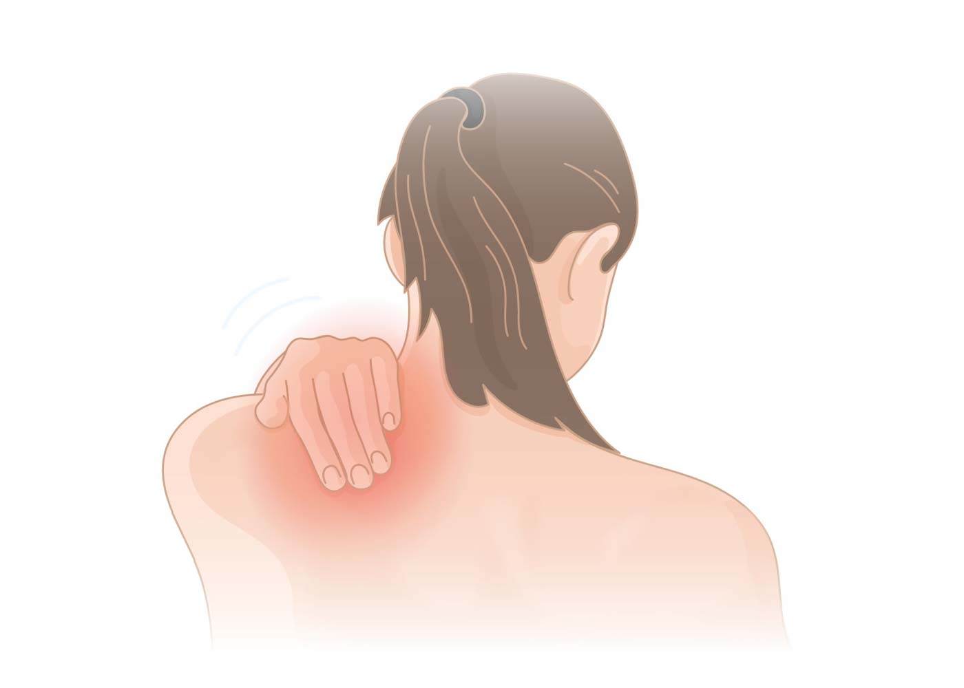 Introduction to the Hijama for Shoulder Pain
