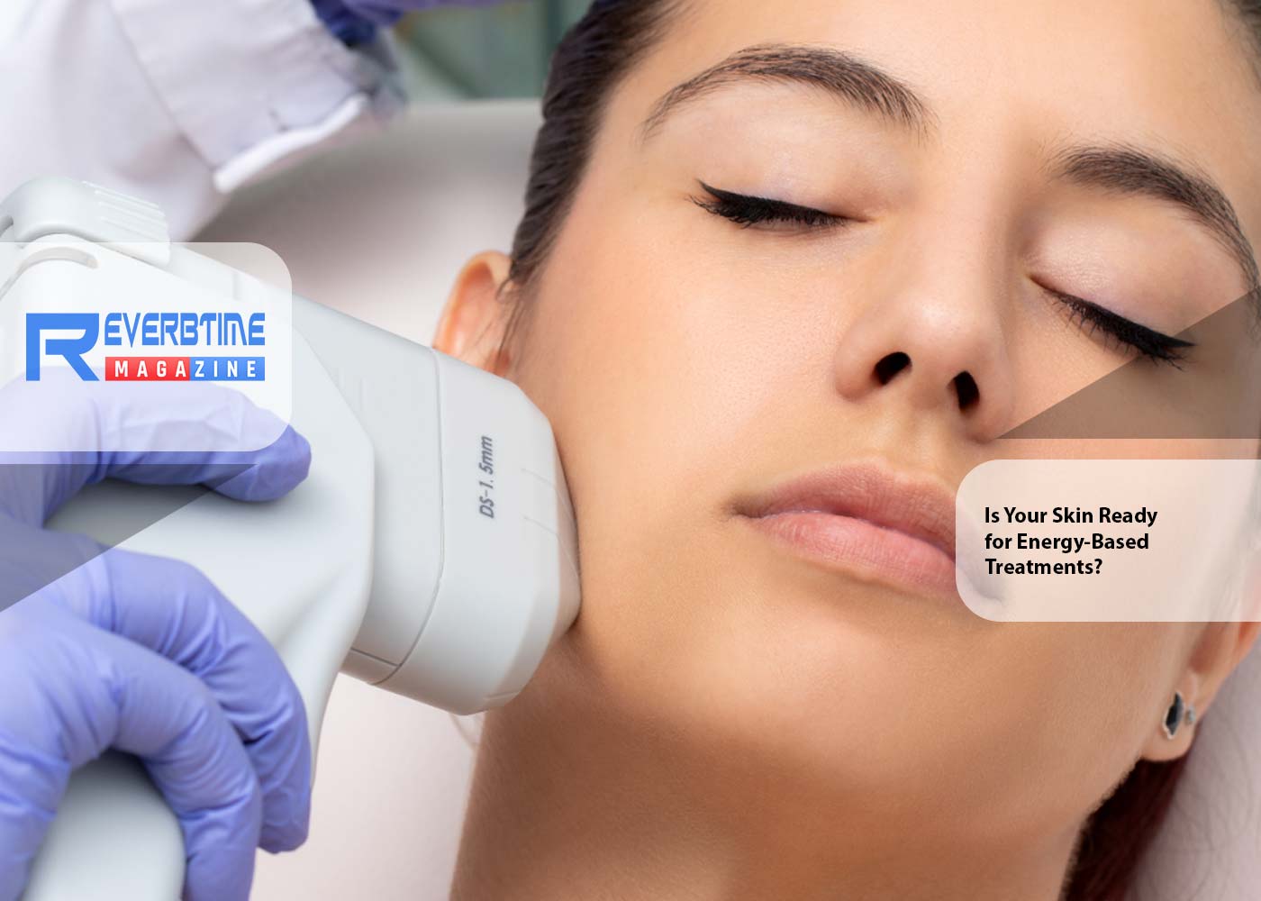 Is Your Skin Ready for Energy-Based Treatments Like HIFU or RF Microneedling?