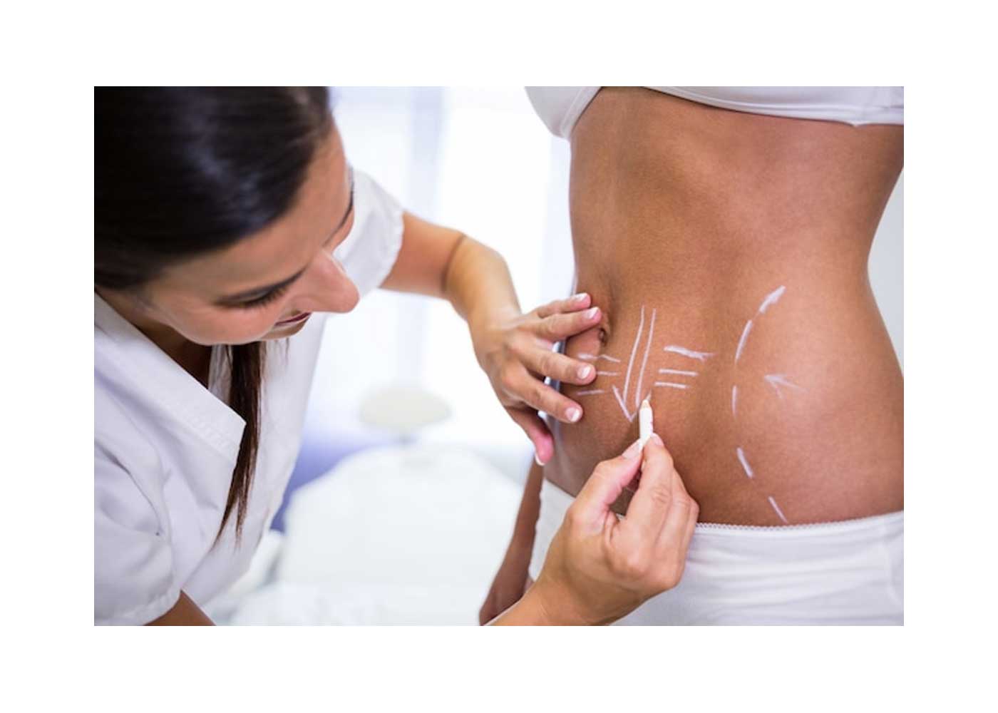 What Are Liposuction and Liposuction in Turkey