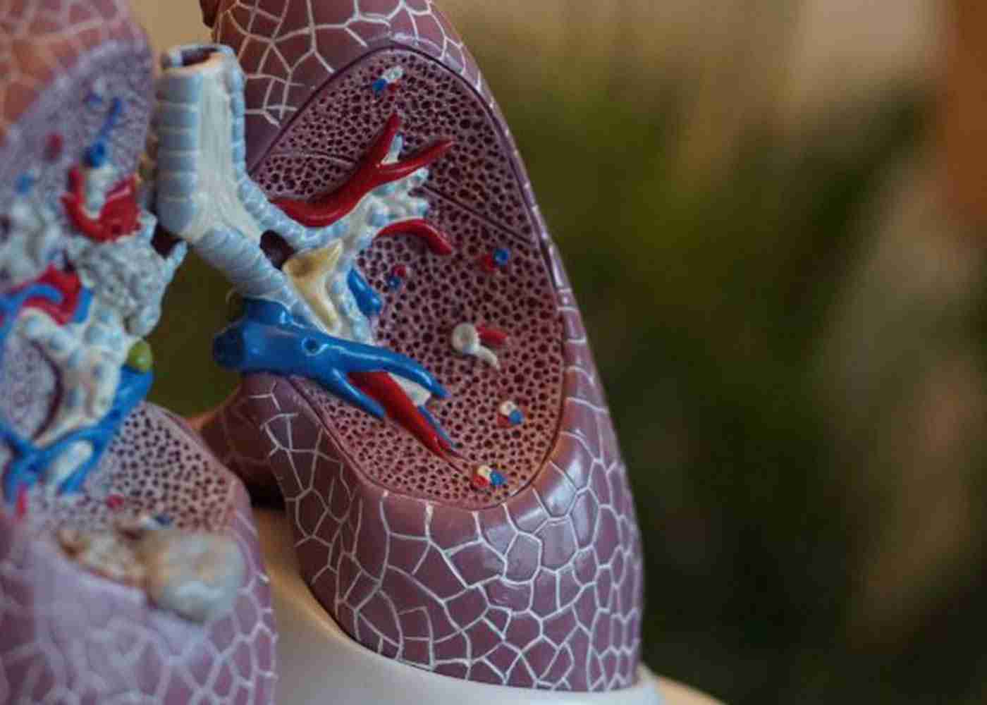 Signs that You Have Mesothelioma and What to Do Next 