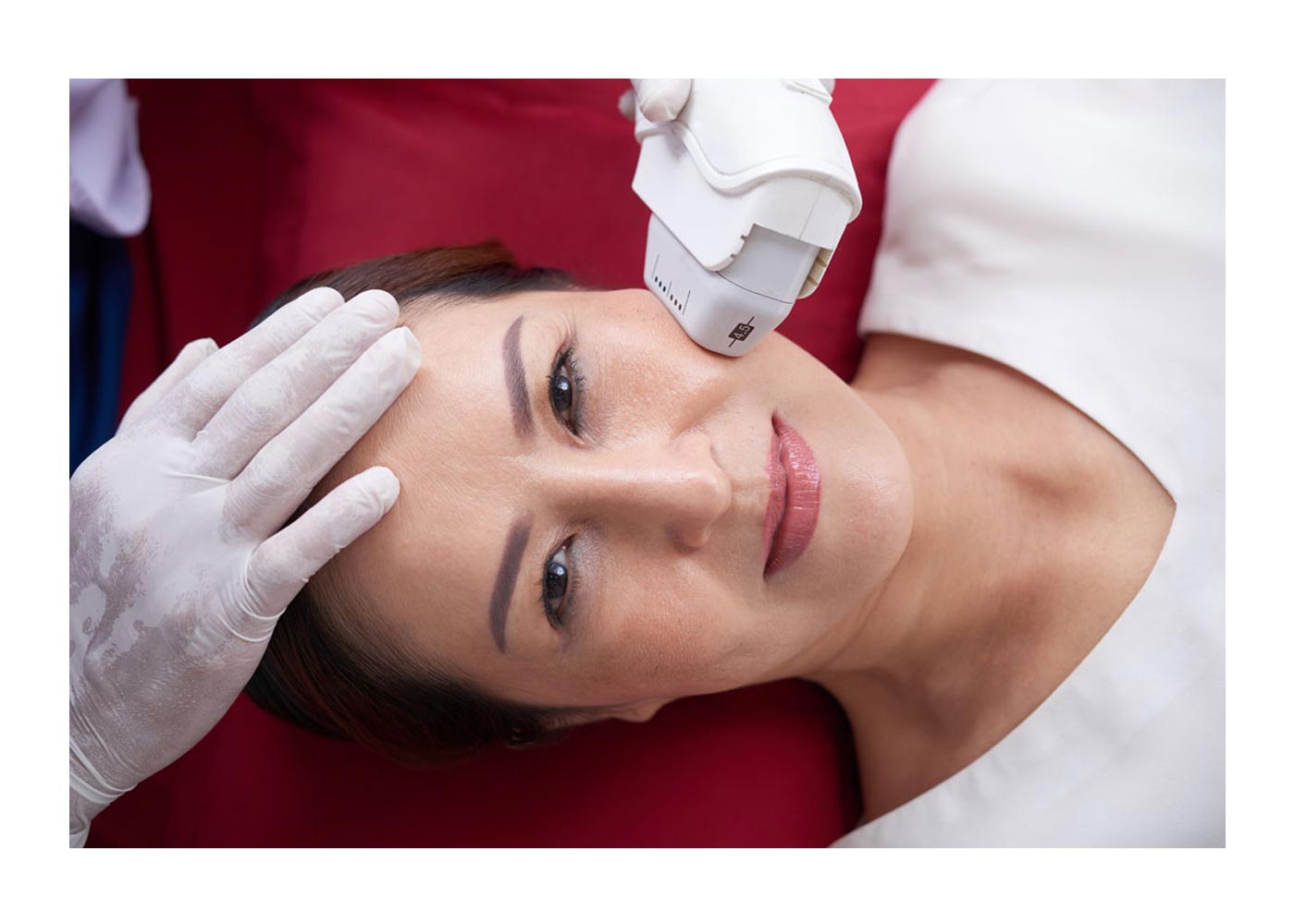 The Superiority of PicoSure Laser Skin Rejuvenation: Unveiling Radiant and Healthy Skin