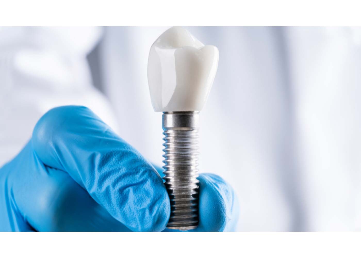 What Factors Contribute to Dental Implants Being the Optimal Choice for Tooth Replacement?