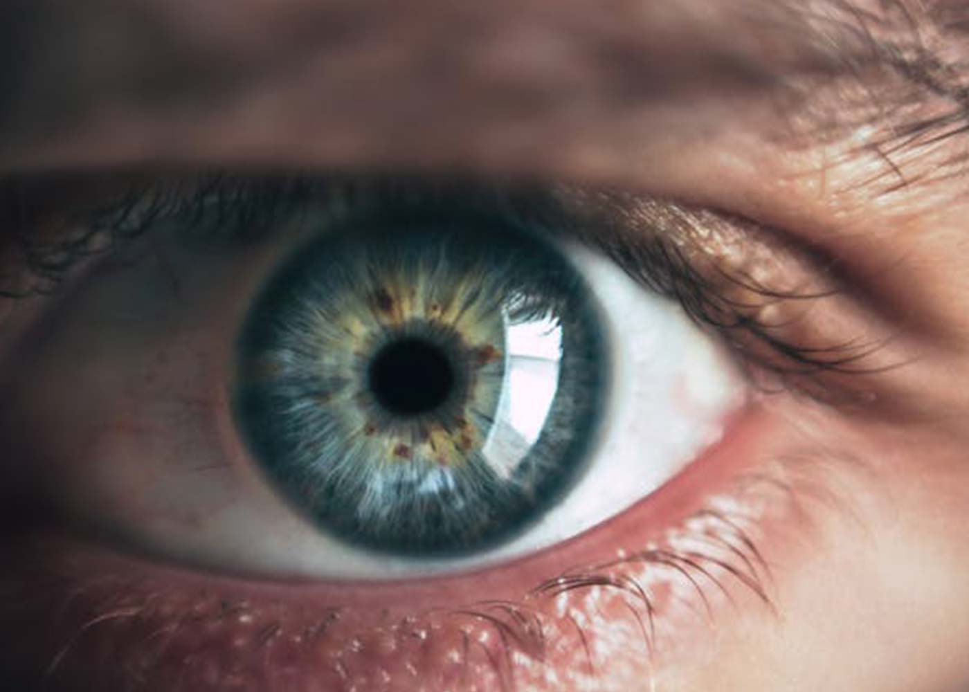 What to Expect Before, During, and After a Cataract Surgery