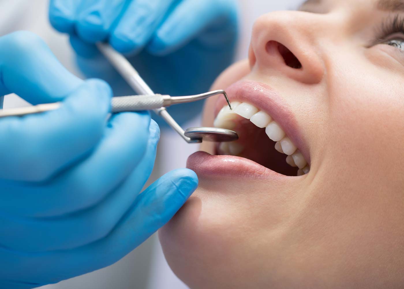 Tooth Trouble? Don't Panic! Your Guide to Dental Emergencies in Newcastle